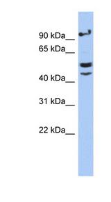 VSIG1 antibody LS-C111718 Western blot of MCF7 cell lysate.