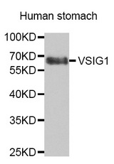 Western blot analysis of extracts of Human stomach, using VSIG1 antibody.