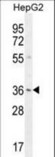 VSIG1 Antibody western blot of HepG2 cell line lysates (35 ug/lane). The VSIG1 antibody detected the VSIG1 protein (arrow).