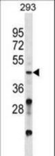 VSX2 Antibody western blot of 293 cell line lysates (35 ug/lane). The VSX2 antibody detected the VSX2 protein (arrow).