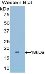 Western blot of recombinant VSX2 / CHX10.