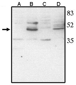 Western blot of anti-Chk10 (CT) antibody at 1 ug/ml on rat liver (A), retina tissue lysate (B), mouse liver (C) and retina (D) tissue lysate.