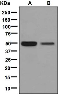 Western blot analysis on (A) Y79 and (B) fetal liver lysates using anti-VSX2 / CHX10 antibody.