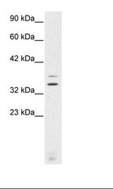 Jurkat Cell Lysate