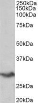 VTCN1 antibody (0.2 ug/ml) staining of Human Spleen lysate (35 ug protein in RIPA buffer). Primary incubation was 1 hour. Detected by chemiluminescence.