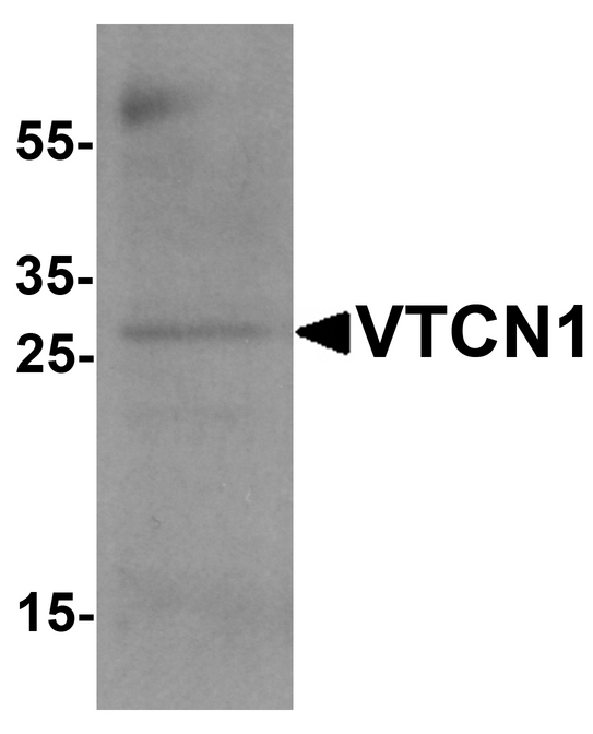 Western blot analysis of VTCN1 in EL4 cell lysate with VTCN1 antibody at 1 ug/ml.