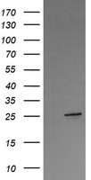 HEK293T cells were transfected with the pCMV6-ENTRY control (Left lane) or pCMV6-ENTRY VTI1A (Right lane) cDNA for 48 hrs and lysed. Equivalent amounts of cell lysates (5 ug per lane) were separated by SDS-PAGE and immunoblotted with anti-VTI1A.