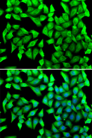 Immunofluorescence blot of U20S cell using VTI1B antibody. Blue: DAPI for nuclear staining.