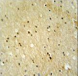VWA3B antibody immunohistochemistry of formalin-fixed and paraffin-embedded human brain tissue followed by peroxidase-conjugated secondary antibody and DAB staining.