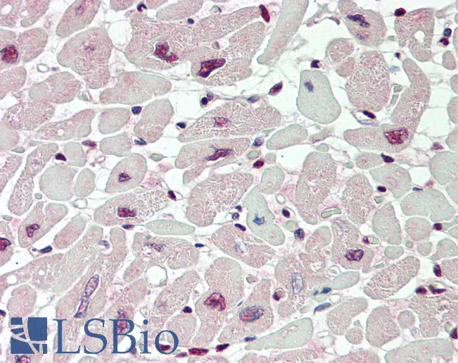 Human Heart: Formalin-Fixed, Paraffin-Embedded (FFPE)