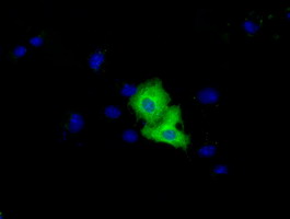 Anti-VMA5A mouse monoclonal antibody immunofluorescent staining of COS7 cells transiently transfected by pCMV6-ENTRY VMA5A.