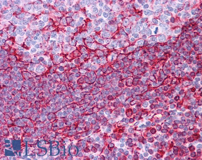 Anti-Vimentin antibody IHC of human tonsil. Immunohistochemistry of formalin-fixed, paraffin-embedded tissue after heat-induced antigen retrieval. Antibody LS-B4669 concentration 5 ug/ml.