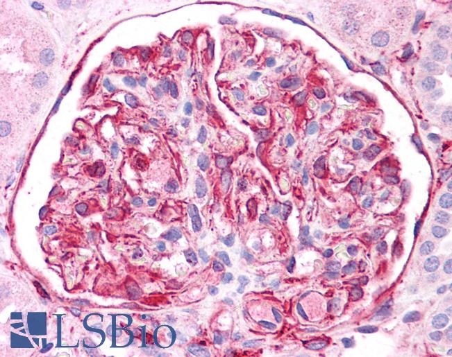Anti-Vimentin antibody IHC of human kidney. Immunohistochemistry of formalin-fixed, paraffin-embedded tissue after heat-induced antigen retrieval. Antibody LS-B4669 concentration 5 ug/ml.