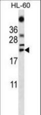 TNF Antibody western blot of HL-60 cell line lysates (35 ug/lane). The TNF antibody detected the TNF protein (arrow).