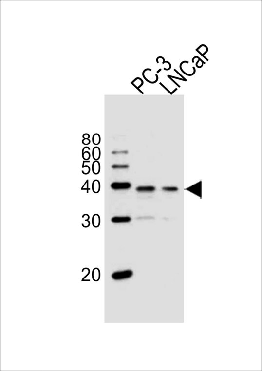 Western blot of lysates from PC-3, LNCaP cell line (from left to right), using VDR Antibody. Antibody was diluted at 1:1000 at each lane. A goat anti-rabbit IgG H&L (HRP) at 1:10000 dilution was used as the secondary antibody.