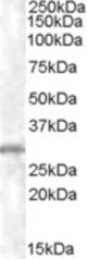 Antibody staining (0.5 ug/ml) of K562 lysate (35 ug protein in RIPA buffer). Primary incubation was 1 hour. Detected by chemiluminescence.
