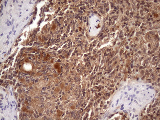 IHC of paraffin-embedded Human thyroid tissue using anti-CHMP5 mouse monoclonal antibody. (Heat-induced epitope retrieval by Tris-EDTA, pH8.0)(1:150).