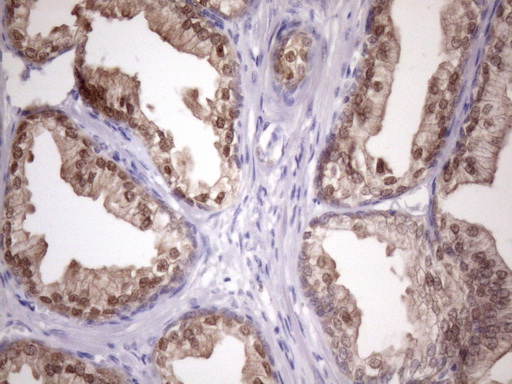 IHC of paraffin-embedded Human prostate tissue using anti-CHMP5 mouse monoclonal antibody. (Heat-induced epitope retrieval by Tris-EDTA, pH8.0)(1:150).