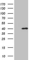 HEK293T cells were transfected with the pCMV6-ENTRY control (Left lane) or pCMV6-ENTRY CHMP5 (Right lane) cDNA for 48 hrs and lysed. Equivalent amounts of cell lysates (5 ug per lane) were separated by SDS-PAGE and immunoblotted with anti-CHMP5 (1:2000).