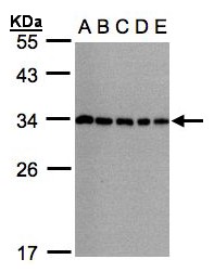 Sample (30g whole cell lysate). A:293T, B: A431 , C: H1299, D: HeLa S3 , E: Hep G2 . 12% SDS PAGE. Vps60 / CHMP5 antibody diluted at 1:1000