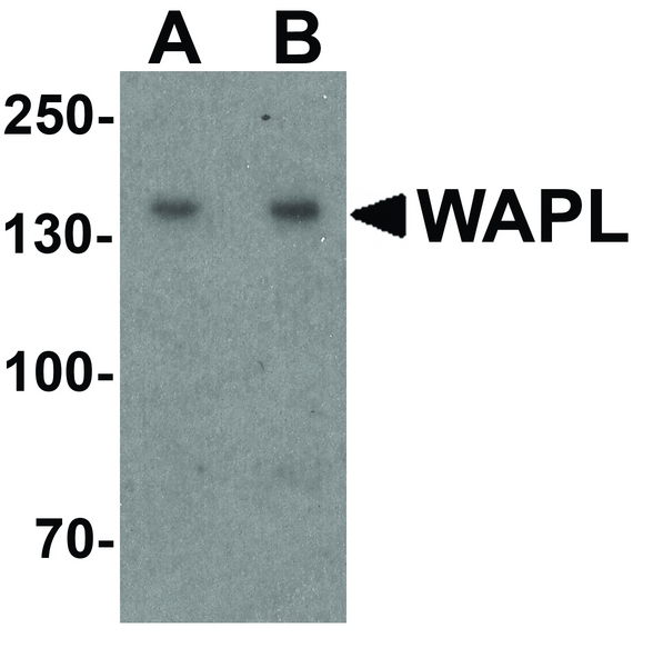 Western blot analysis of WAPL in A20 cell lysate with WAPL antibody at (A) 1 and (B) 2 ug/ml.