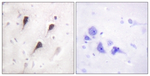 IHC of paraffin-embedded human brain tissue, using WAVE1 (Ab-125) Antibody. The picture on the right is treated with the synthesized peptide.