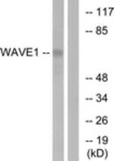 Western blot of extracts from 293 cells, treated with insulin 0.01U/ml 15', using WAVE1 (Ab-125) Antibody. The lane on the right is treated with the synthesized peptide.