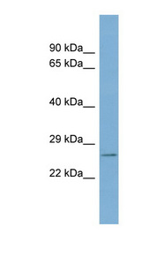 WBP2 antibody LS-C107696 Western blot of Fetal Thymus lysate.