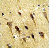 Formalin-fixed and paraffin-embedded human brain tissue reacted with WBP2 Antibody , which was peroxidase-conjugated to the secondary antibody, followed by DAB staining. This data demonstrates the use of this antibody for immunohistochemistry; clinical relevance has not been evaluated.