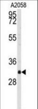 Western blot of anti-BP2 Antibody in A2058 cell line lysates (35 ug/lane). BP2(arrow) was detected using the purified antibody.