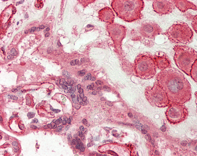 Human Placenta: Formalin-Fixed, Paraffin-Embedded (FFPE)