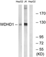 Western blot of extracts from Jurkat/HepG2 cells, using WDHD1 Antibody. The lane on the right is treated with the synthesized peptide.