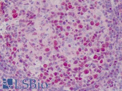 Anti-WDHD1 antibody IHC of human tonsil. Immunohistochemistry of formalin-fixed, paraffin-embedded tissue after heat-induced antigen retrieval. Antibody LS-B1656 concentration 15 ug/ml.