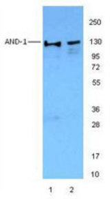 Jurkat nuclear cell extracts (lane 1) and NIH3T3 nuclear extracts were resolved by electrophoresis, transferred to nitrocellulose, and probed with anti-AND-1 antibody (clone 20G10). Proteins were visualized using a goat anti-mouse-IgG secondary conjugated to HRP and chemiluminescence detection.