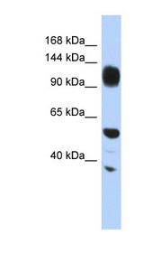 WDHD1 antibody LS-B5594 Western blot of HepG2 cell lysate.