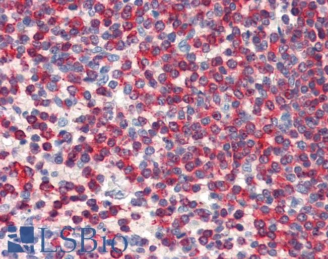 Anti-WDHD1 antibody IHC of human spleen. Immunohistochemistry of formalin-fixed, paraffin-embedded tissue after heat-induced antigen retrieval. Antibody LS-B5642 concentration 5 ug/ml.