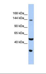 Hela cell lysate. Antibody concentration: 1.0 ug/ml. Gel concentration: 6-18%.