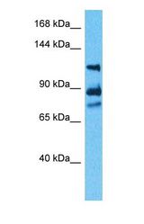 Western blot of WDHD1 Antibody with human 293T Whole Cell lysate.