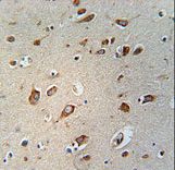 CB086 Antibody immunohistochemistry of formalin-fixed and paraffin-embedded human brain tissue followed by peroxidase-conjugated secondary antibody and DAB staining.