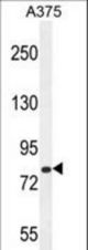 CB086 Antibody western blot of A375 cell line lysates (35 ug/lane). The CB086 antibody detected the CB086 protein (arrow).