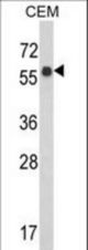 Western blot of WDR1 Antibody in CEM cell line lysates (35 ug/lane). WDR1 (arrow) was detected using the purified antibody.