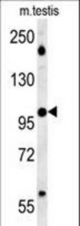 BRWD2 Antibody western blot of mouse testis tissue lysates (15 ug/lane). The BRWD2 antibody detected BRWD2 protein (arrow).
