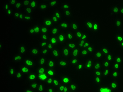 Immunofluorescence blot of MCF7 cell using PHIP antibody.