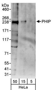 Detection of Human PHIP by Western Blot. Samples: Whole cell lysate (5, 15 and 50 ug) from HeLa cells. Antibody: Affinity purified rabbit anti-PHIP antibody used for WB at 0.04 ug/ml. Detection: Chemiluminescence with an exposure time of 3 minutes.