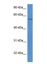 WDR12 antibody LS-C145258 Western blot of Mouse Spleen lysate. Antibody concentration 1 ug/ml.