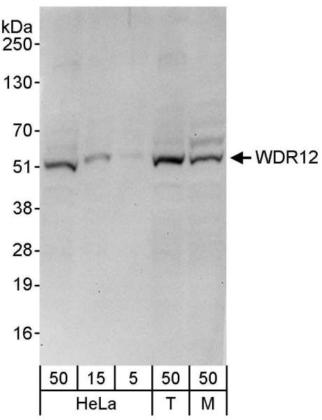Detection of Human and Mouse WDR12 by Western Blot. Samples: Whole cell lysate from HeLa (5, 15 and 50 ug), 293T (T; 50 ug), and mouse NIH3T3 (M; 50 ug) cells. Antibody: Affinity purified rabbit anti-WDR12 antibody used for WB at 0.1 ug/ml. Detection: Chemiluminescence with an exposure time of 30 seconds.