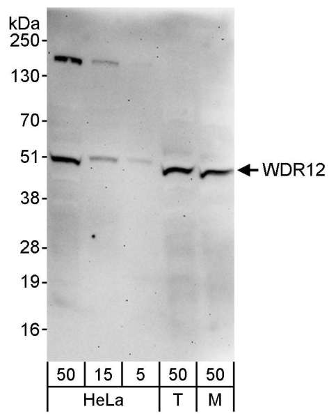 Detection of Human and Mouse WDR12 by Western Blot. Samples: Whole cell lysate from HeLa (5, 15 and 50 ug), 293T (T; 50 ug), and mouse NIH3T3 (M; 50 ug) cells. Antibody: Affinity purified rabbit anti-WDR12 antibody used for WB at 0.1 ug/ml. Detection: Chemiluminescence with an exposure time of 3 minutes.