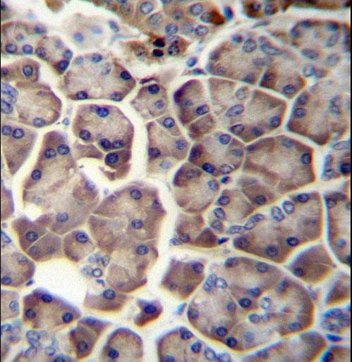 WDR12 Antibody immunohistochemistry of formalin-fixed and paraffin-embedded human pancreas tissue followed by peroxidase-conjugated secondary antibody and DAB staining.
