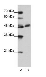 A: Marker, B: Jurkat Cell Lysate