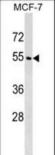 WDR20 Antibody western blot of MCF-7 cell line lysates (35 ug/lane). The WDR20 antibody detected the WDR20 protein (arrow).